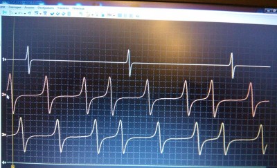 1-CMP; 2, 3-VVT Sensors